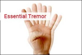 Treatment of Essential Tremor
