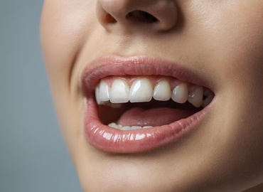 Bruxism: Causes, Symptoms, and Effective Treatment