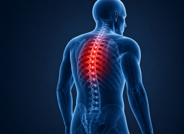 Kyphosis and Neurological Complications: What Every Patient Should Know